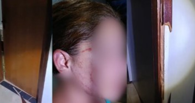 mulher-e-agr-dida-pelo-companheiro-na-frente-da-filha-de-2-anos-em-tapurah