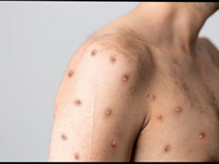 Captura de tela 2026-02-18 094454